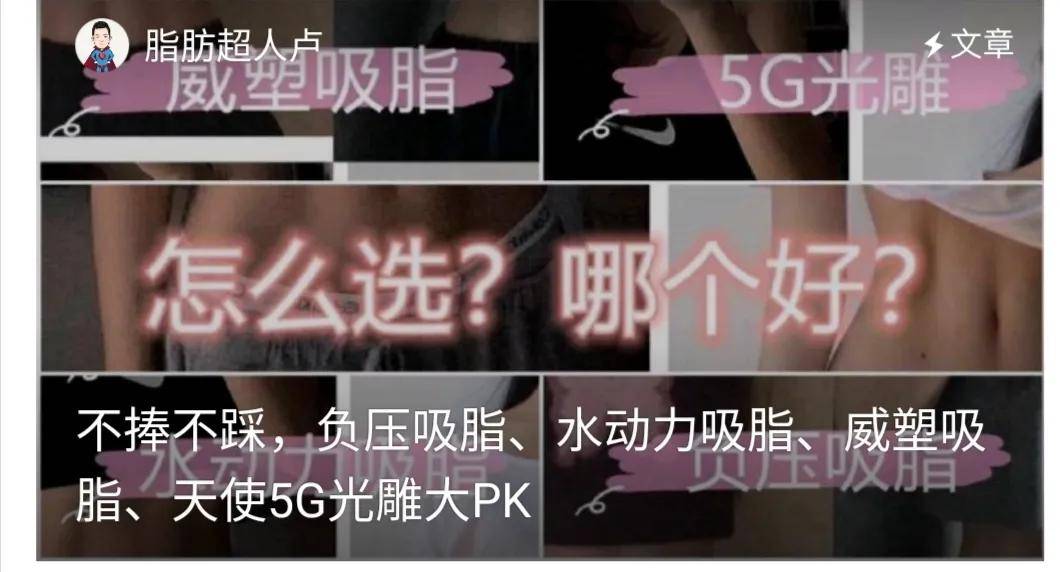 不捧不踩，负压吸脂、水动力吸脂、威塑吸脂、天使5G光雕大PK