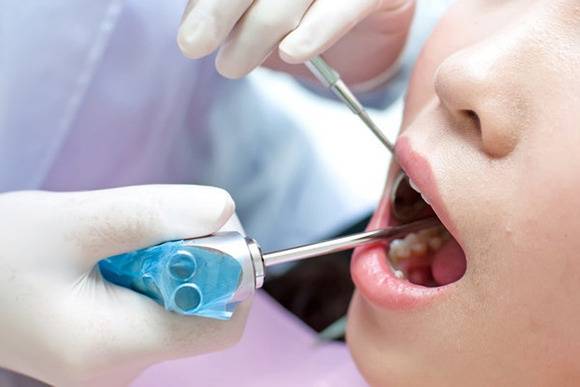看个牙动辄上万，牙科诊所真的在坑人吗？怎样节约成本？