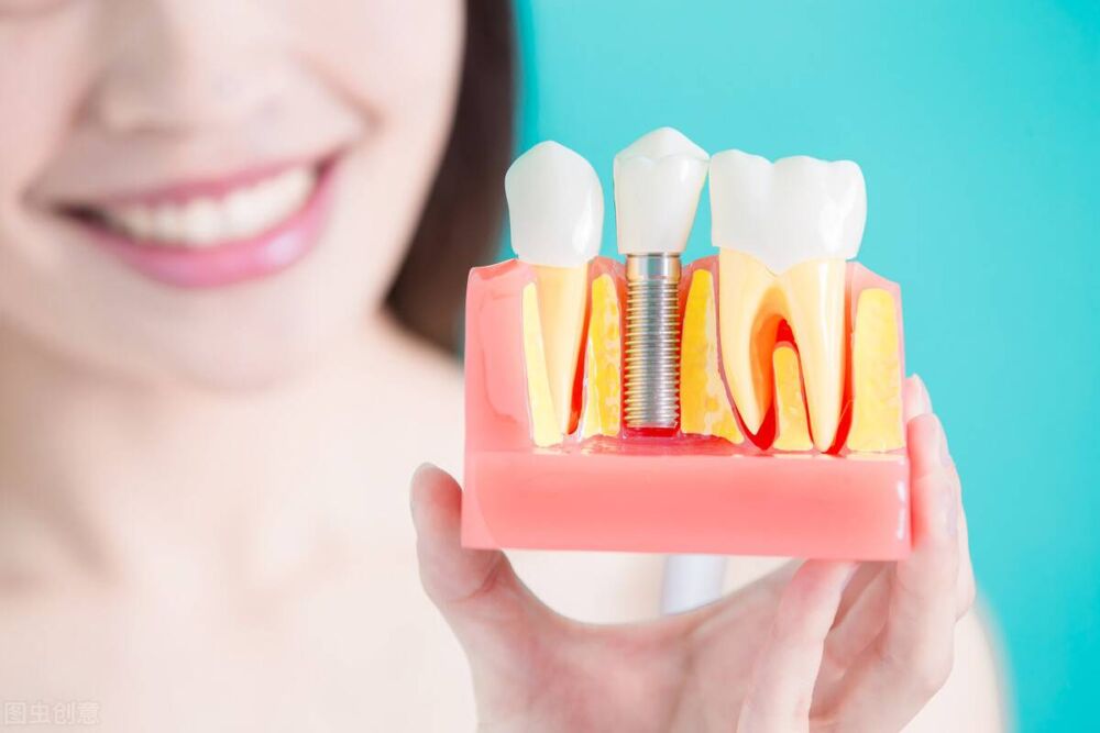 缺牙后，是该选择活动假牙还是种植牙？