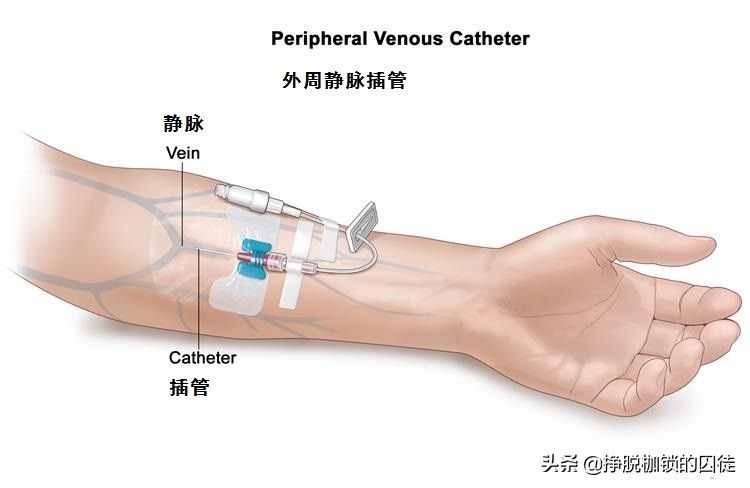 输液时如果空气进入了血管，会有什么后果？