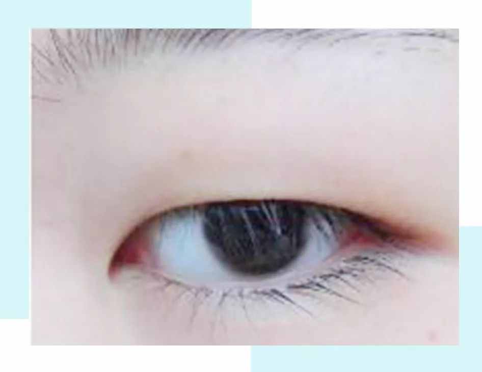 点评丨4种常见的双眼皮，第3是公认的气质型！