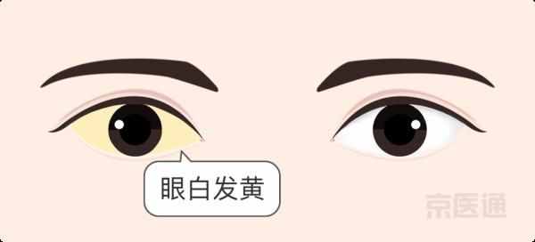 同仁眼科专家：看着很吓人的3种病，其实不用治