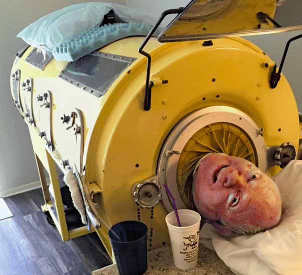 被困“铁桶”69年的铁肺人，一生无法呼吸，停电就意味着死亡