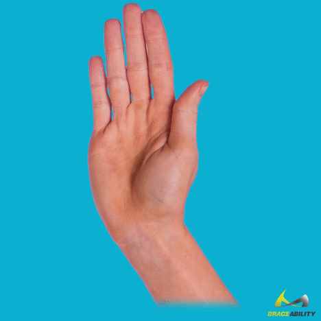 「手指挫伤」怎么办？医生：很多都不严重，可这类情况应该去医院