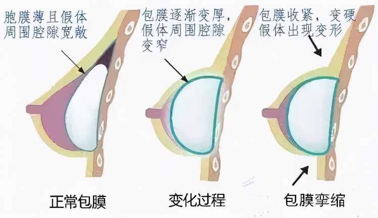 女朋友的胸，为什么忽大忽小？