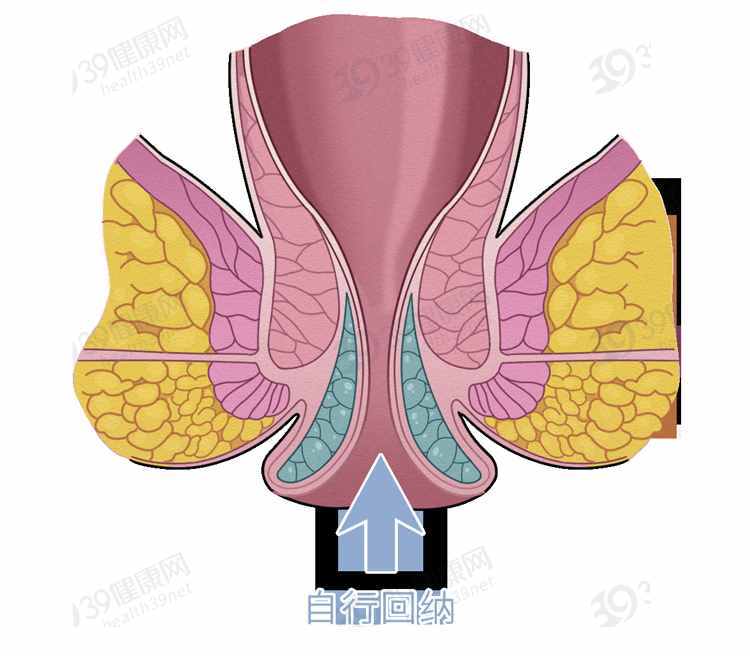 排便时，肛门掉出一块肉是怎么回事？这5类人易被“脱肛”盯上