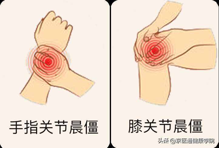 8个动作10分钟，积水潭医生教你一套全身关节操