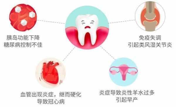 我们到底需不需要洗牙？这些洗牙误区你知道几个？