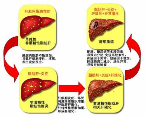 肝脏在身体的哪个部位，有什么功能？一次性告诉你