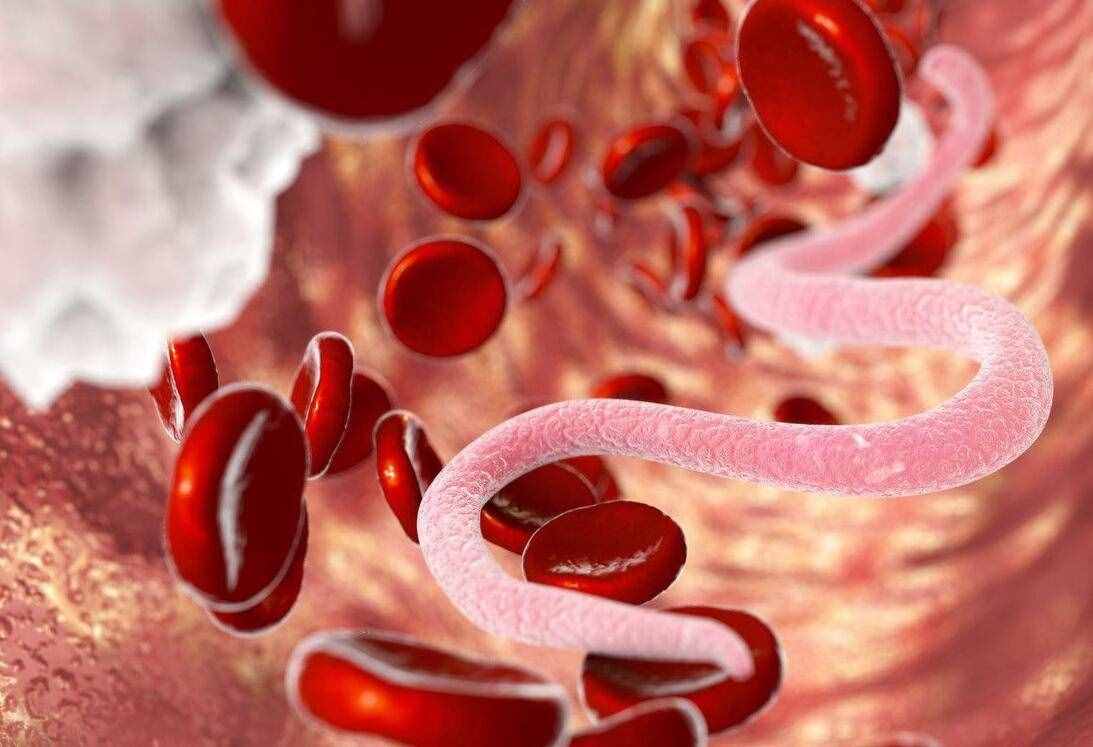 血液黏稠度高就是血脂高吗？如何降低血液粘稠度