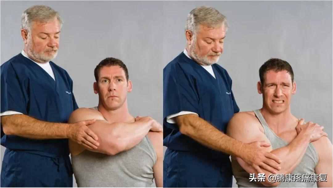肩关节脱位的分类和诊疗