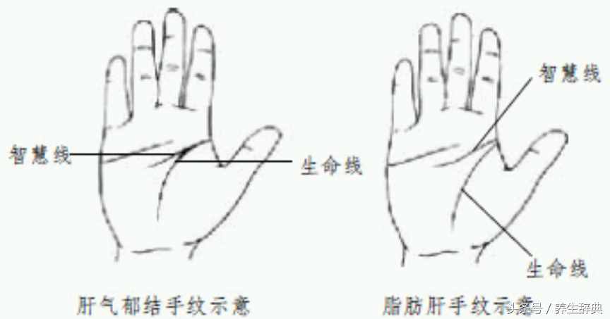 一只手掌看全身：手部反射区详解，让健康尽在“掌”中