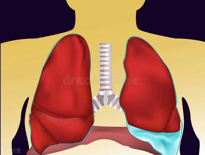 胸腔积液是怎么引起的？
