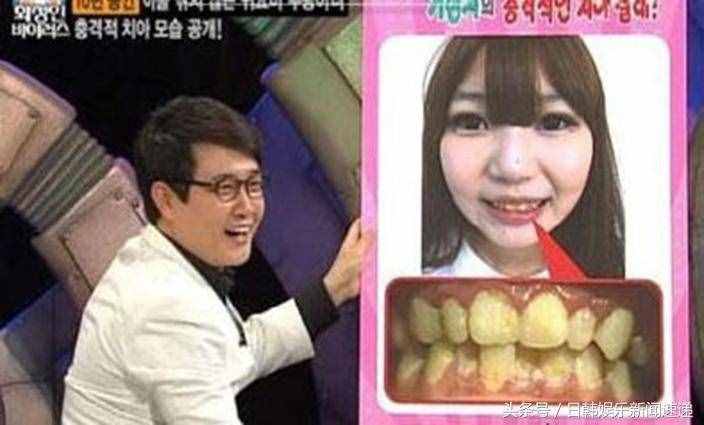 网疯传韩国美少女10年不刷牙开口吓死人