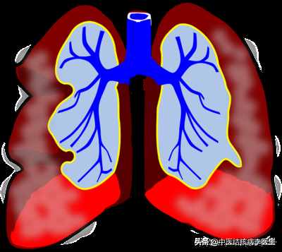 肺结核属于几类传染病？