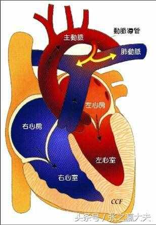 心脑血管疾病的主要治疗方法