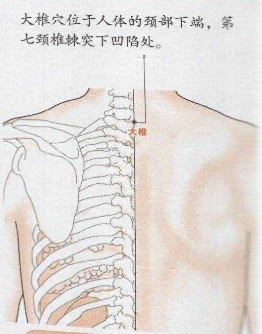 大椎穴位的准确位置图