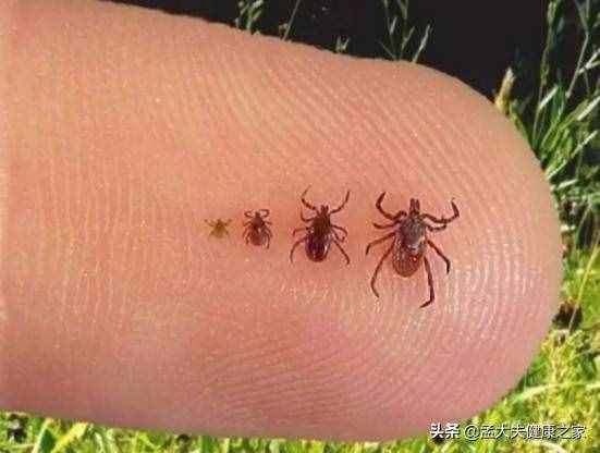 蜱虫可传播多种致命疾病，咬伤后急救处理很关键，该如何防范自救