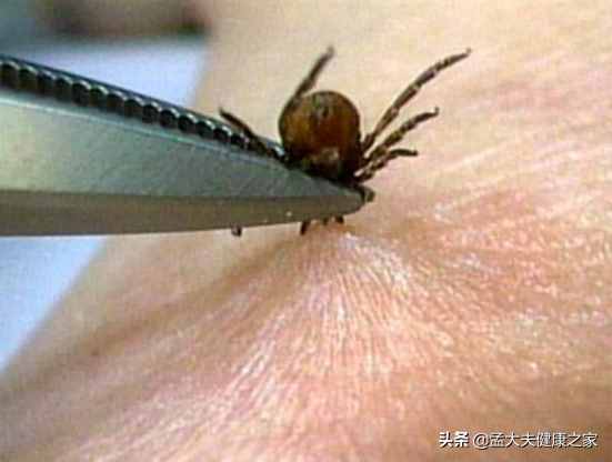 蜱虫可传播多种致命疾病，咬伤后急救处理很关键，该如何防范自救