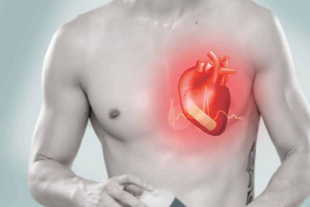引起胸痛常见的12种病因