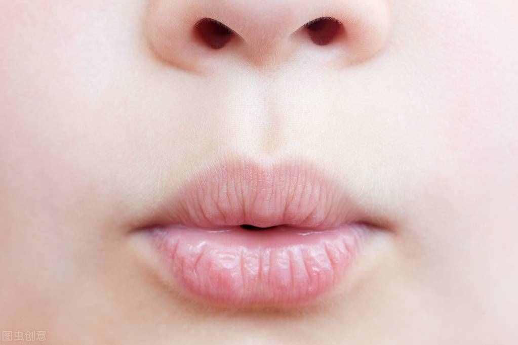 治疗唇炎，有效的措施有哪些，要注意什么？