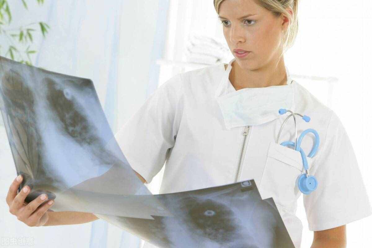 肺癌要如何治疗？这5种治疗方法，可综合运用