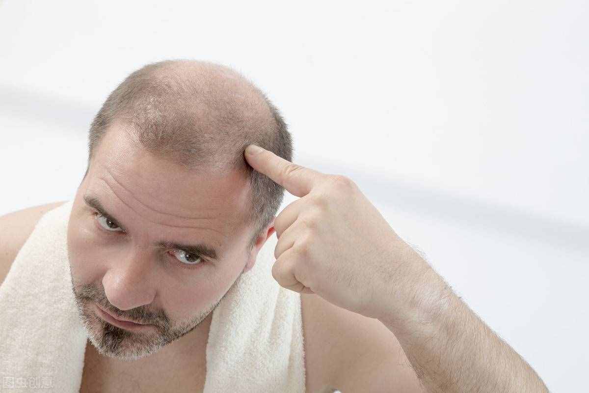 “十个男人，五个秃”，男人为什么会秃顶？预防秃顶小技巧