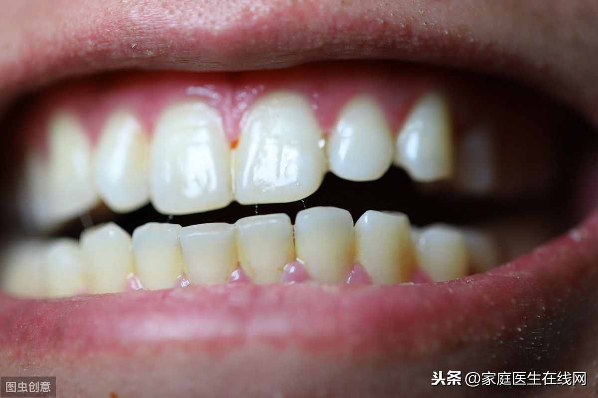 牙釉质“受伤”怎么办？4个方法，让这层保护壳尽快恢复