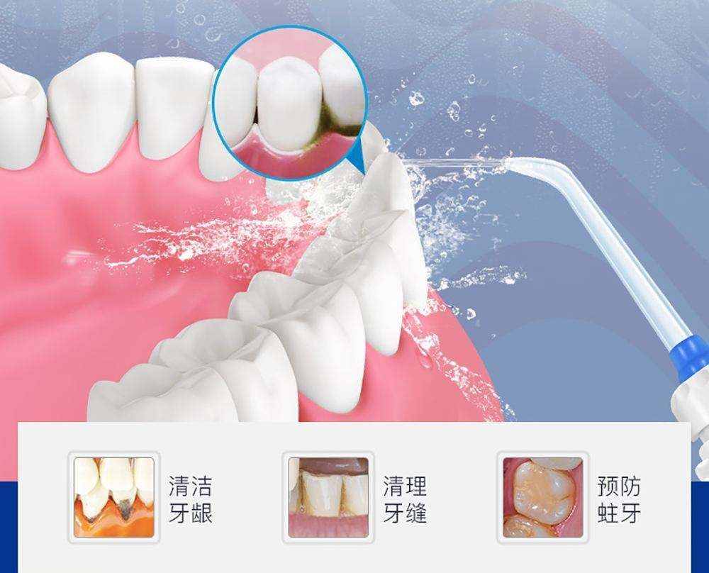 洗牙到底能不能给牙齿洗白白？