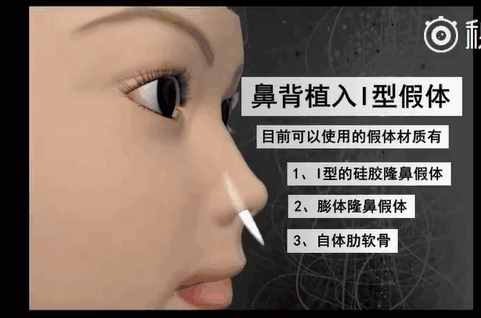 隆鼻有哪些副作用？小心这5大后遗症等着你