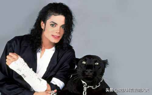 为纪念“音乐之神”迈克尔杰克逊特立世界白癜风日