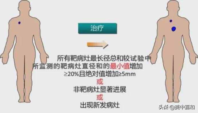 PFS只是过程，OS才是终点