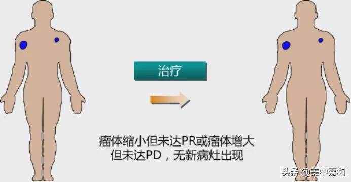 PFS只是过程，OS才是终点