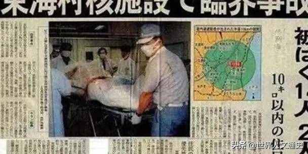 核辐射有多可怕？日本工人全身DNA断裂，高度腐烂，挣扎83天断气