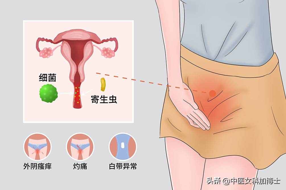 妇科炎症对女性的4大伤害