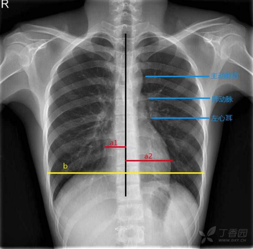 这 10 张经典胸片，影像医生看完都分享了