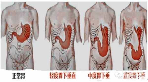 人的胃在身体的左边还是右边，你分的清楚吗？