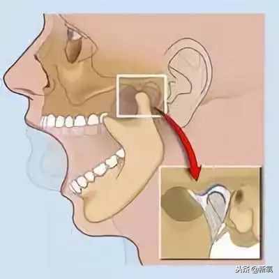 王源吃惊到下巴下颌骨脱位？如果平时心情不开心可能也会中招！