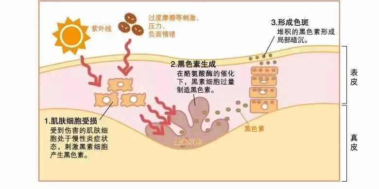 美白的思路千千万，酵母美白真的稳了