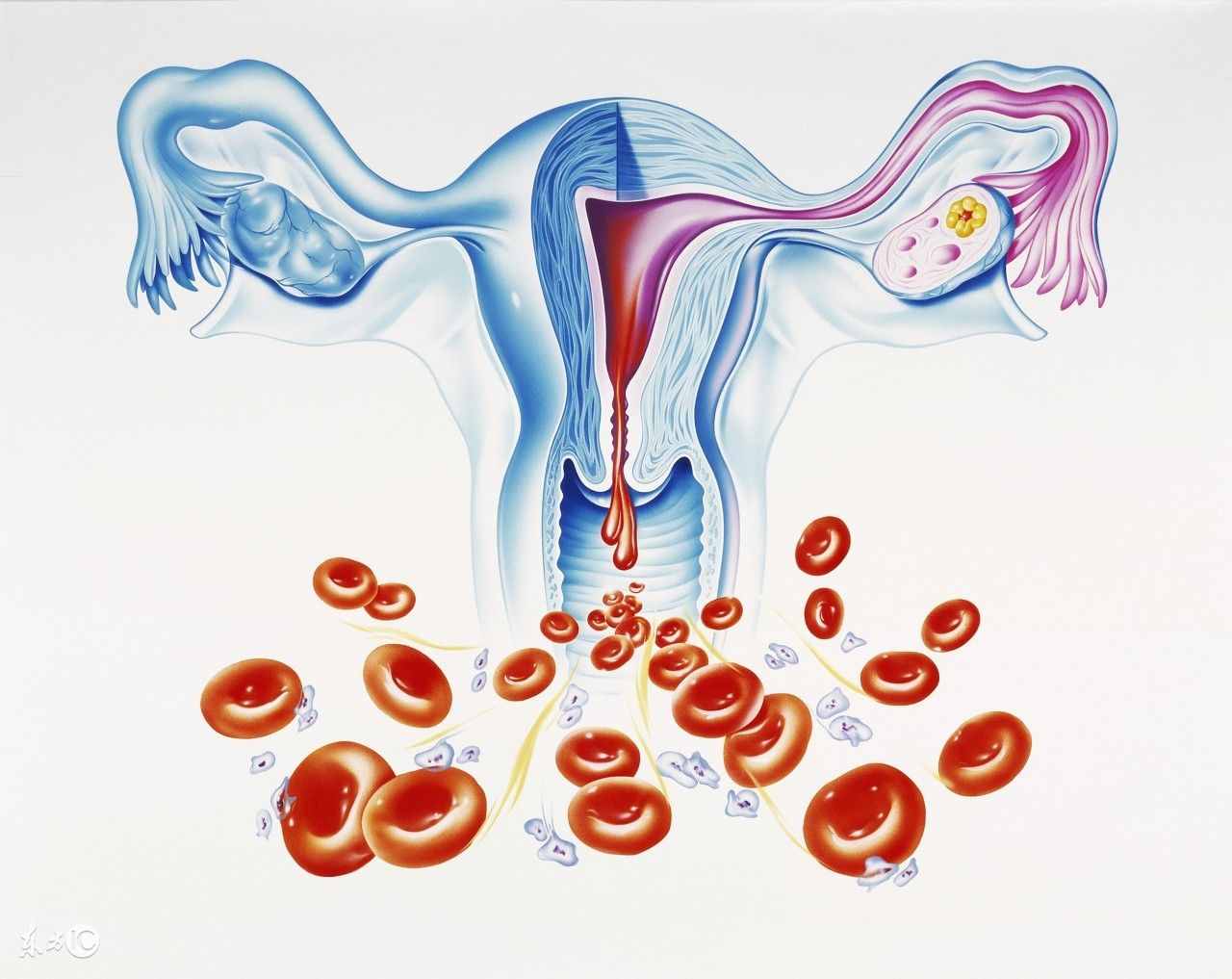 女性阴道出血原来有这么多原因，其中一类和性生活有关