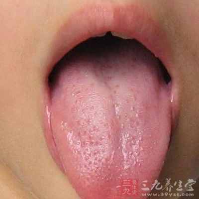 舌苔厚黄是怎么回事 看舌苔知身体状况