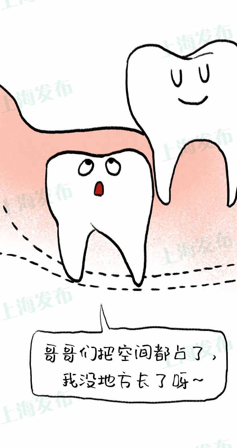 “尽根牙”是嘴巴里的潜伏者，为何会“一痛惊人”？拔还是不拔？