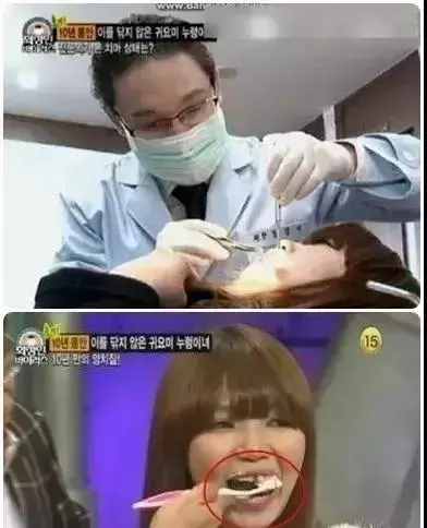 韩国十年不刷牙的妹纸，牙黄口臭简直无法无天......