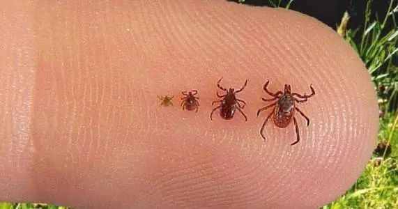 2岁小孩被蜱虫吸血多天，虫子涨大几十倍，取下来还活着