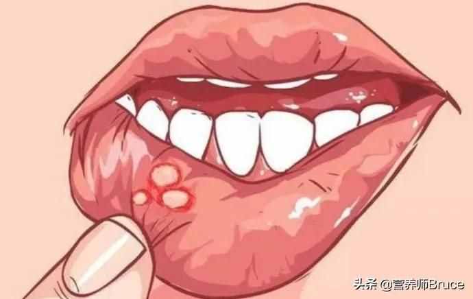 嘴巴里每隔一段时间就会溃疡，这是什么原因？怎么处理？