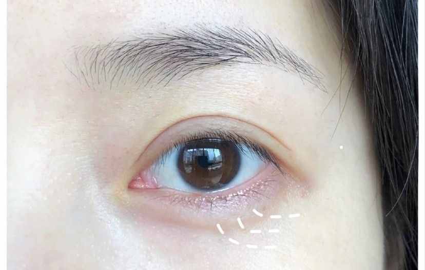 日常眼部护理怎么做？3步教你轻松淡化眼纹，让眼睛更美更亮