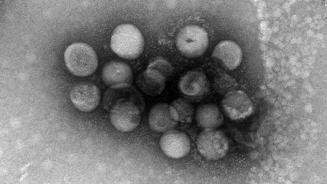 高福院士：高致病性H5N8禽流感病毒已成为值得关注的公共卫生问题丨环球科学要闻