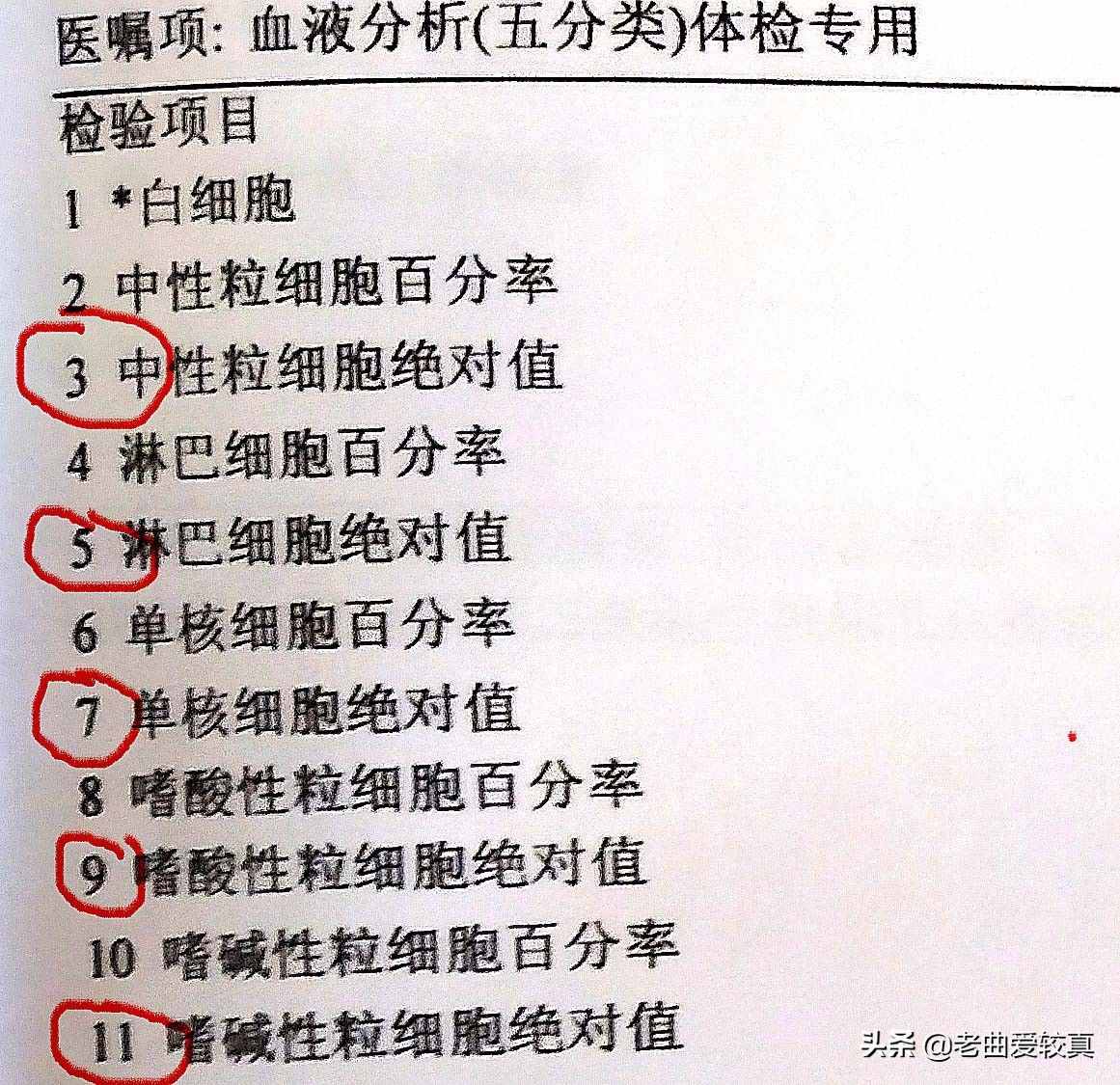 看懂血常规化验单：注意这四个指标