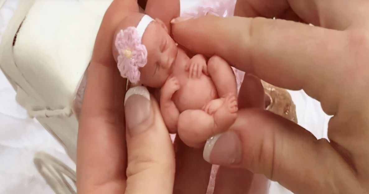 世界上最小的“拇指姑娘”长大，美艳动人，童话果然没骗人