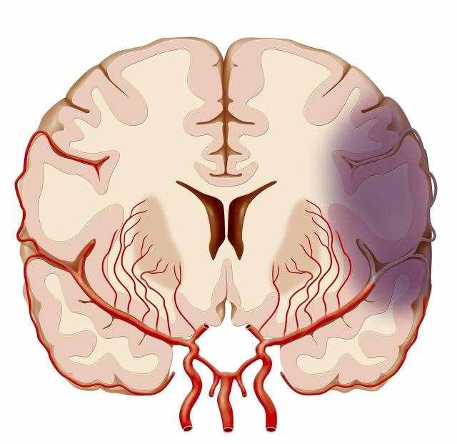 脑供血不足常用这8类药，多角度改善供血供氧，保护脑细胞和神经